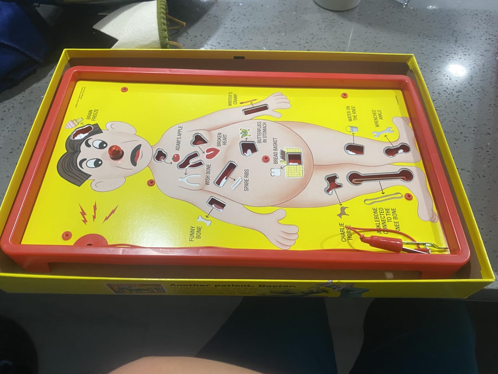 Hasbro Gaming Operation Electronic Board Game, Family Games for Kids Ages 6+, Kids Board Games for 1+ Players, Funny Games for Kids, Easter Gifts for Boys and Girls (Amazon Exclusive) customer photo 1