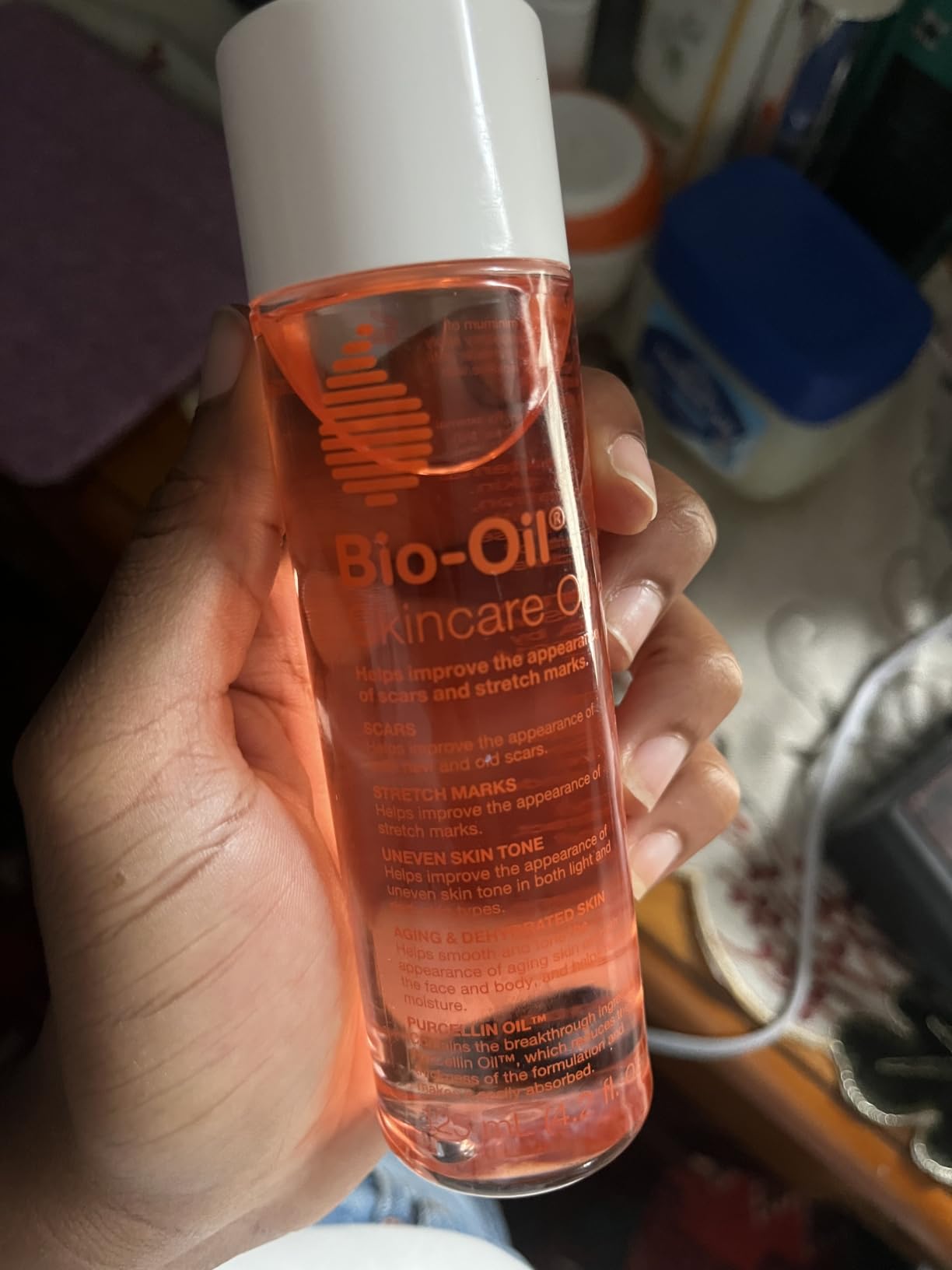Bio-Oil Skincare Body Oil Serum for Scars and Stretch Marks, Face and Body Moisturizer with Vitamin E & A for Sensitive Dry Skin, Dermatologist Recommended, Non-Comedogenic, 4.2 Oz customer photo 1